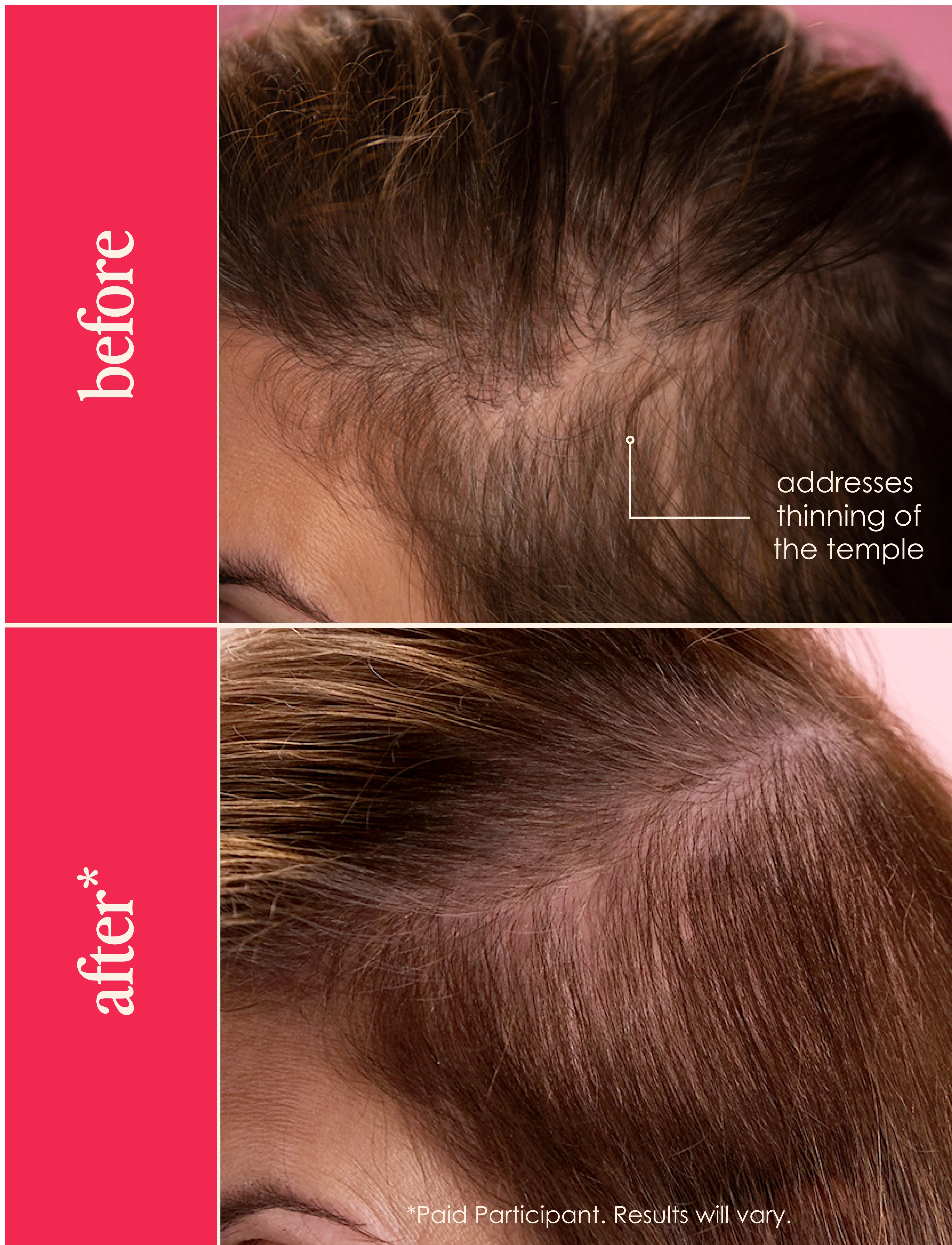 GrandeHAIR Full Boost - Image 5